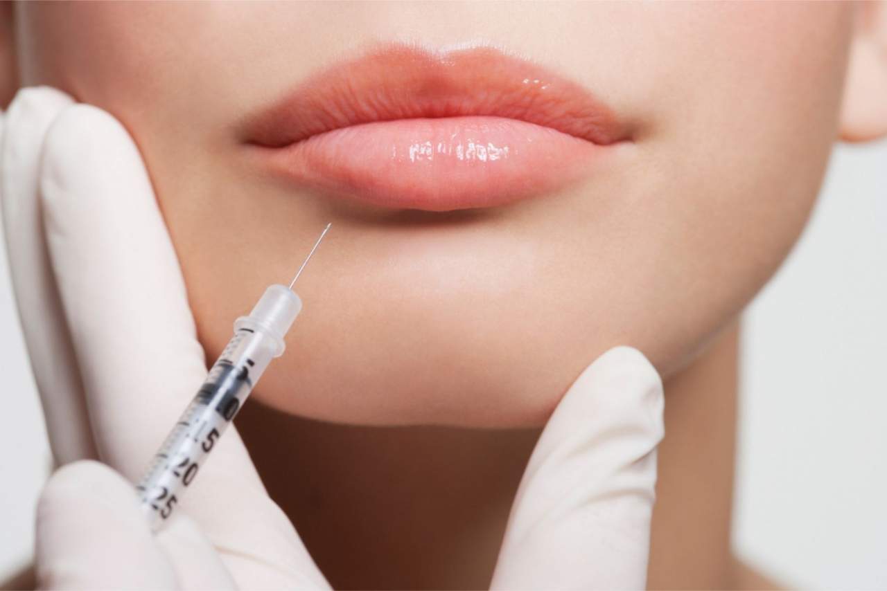 Clínica Dr. Zito: Aumento de labios