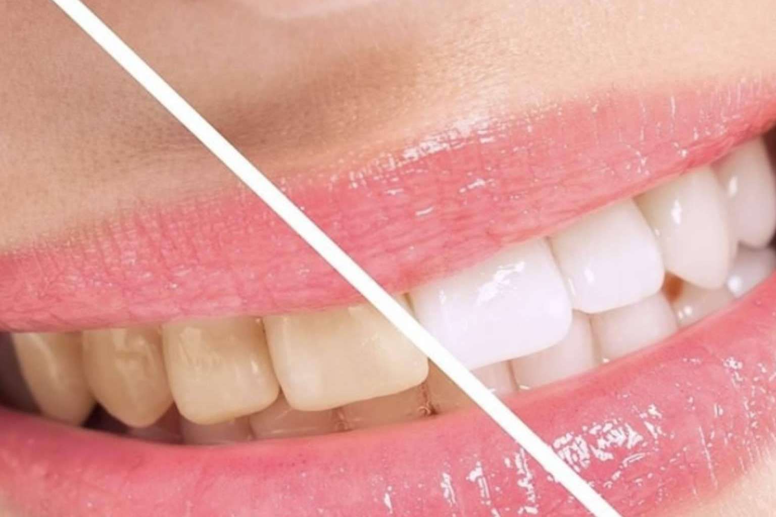 La importancia de realizarse tratamientos dentales de la mano de expertos, como DeltaDent