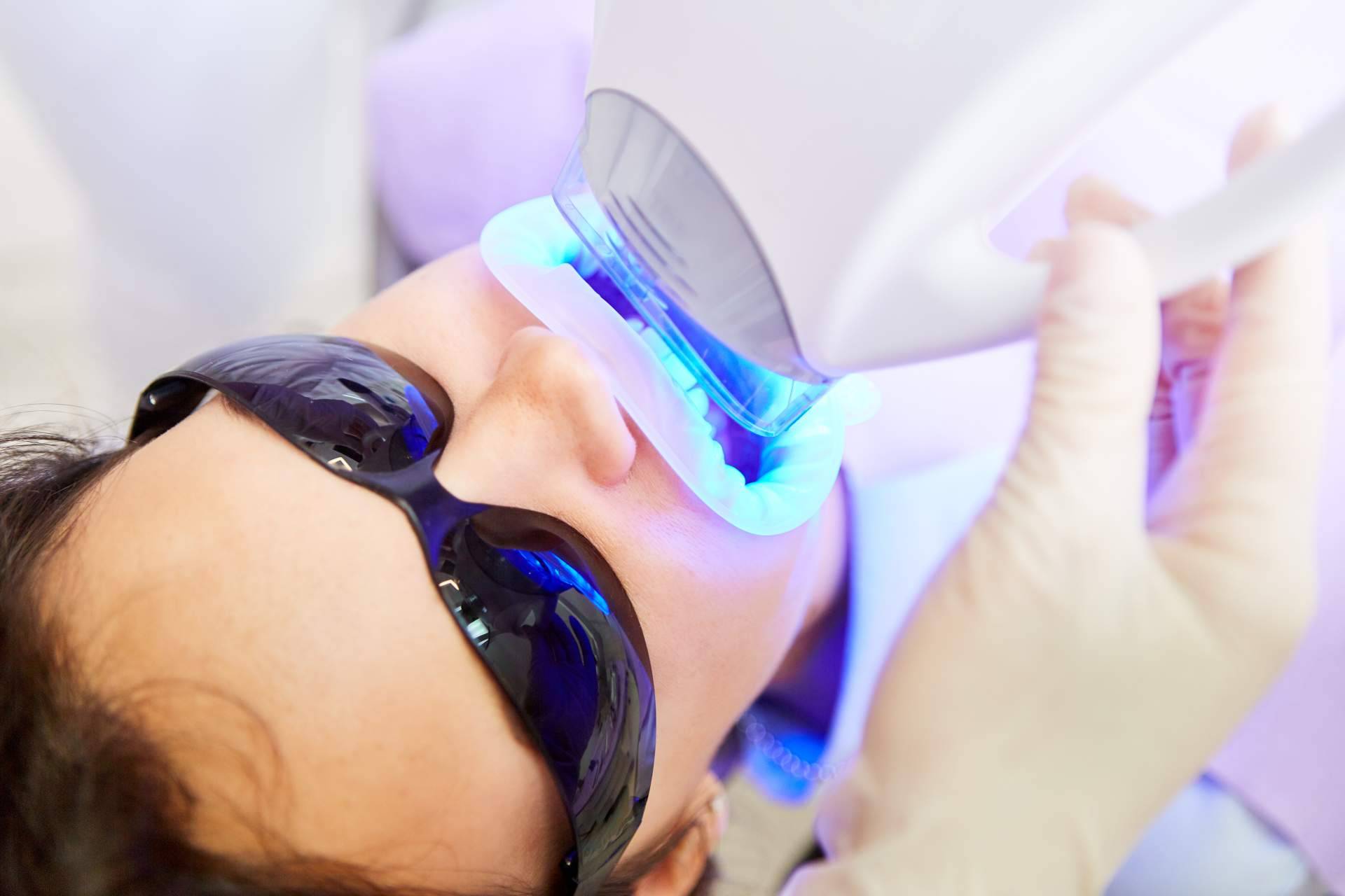 Después de un blanqueamiento dental, ¿cómo hay que cuidar los dientes?