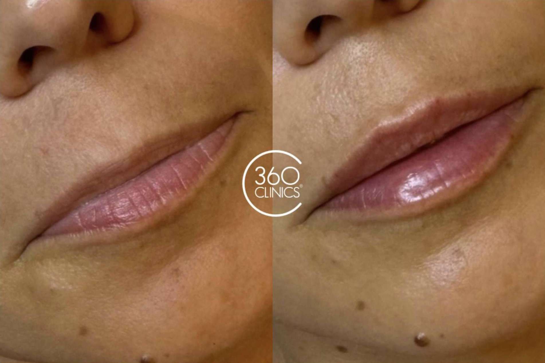 Espejito espejito, quién tiene los labios más bonitos