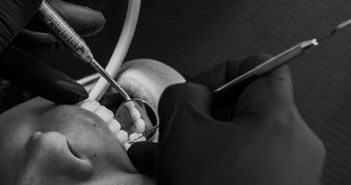 Exö lanza una campaña de prevención dental para concienciar sobre su impacto en la salud general